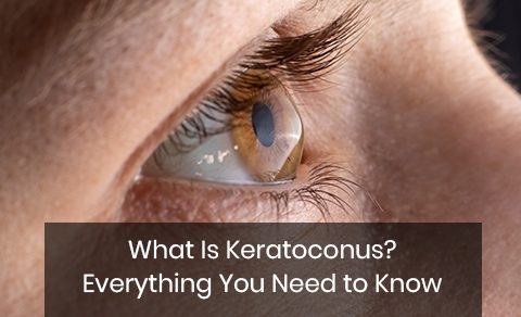 What Is Keratoconus? Everything You Need to Know