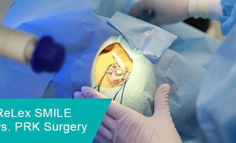 ReLex SMILE vs. PRK surgery