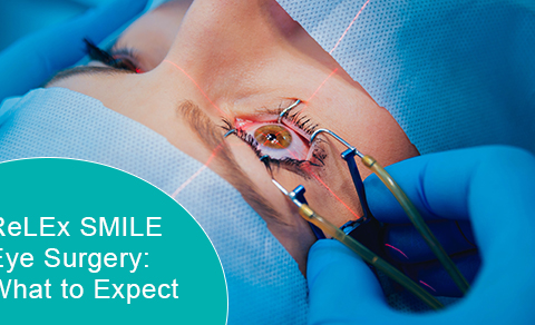 ReLEx SMILE eye surgery: What to expect
